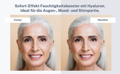 DermaAktiv Feuchtigkeits-Booster mit straffender Wirkung, 10 Ampullen - Made in Germany